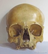 Eredeti emberi koponya.. kb. 100 éves