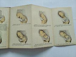 Antique book: atlas of obstetrics from 1903