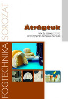 Peter Storz · Georg Gloeckner: Átrágtuk