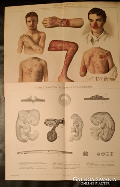 "Betegségek"  2 darab melléklet a Pallas lexikonból