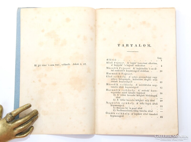 1842 - Dr. Virányi Kálmán - Nincs többé kopasz fej! A haj-bajok gyógyítása Ritka orvosi könyv !!